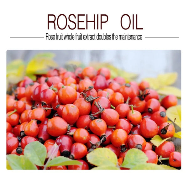 Rosehip Oil-ToShay.org