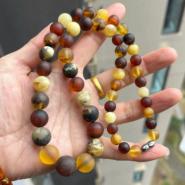 Yellow Amber Bead Necklace-ToShay.org